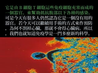它是由 B 細胞 T 細胞這些免疫細胞充塞而成的
一個器官，來幫 助抵抗腹部以下各種的感染。
可是今天有很多人仍然認為它是一個沒有用的
器官。若今天可以繼續用手術的方式來作預防
，為何不割掉心臟，那就不會得心臟病。所以
，我們也就知道免疫學是一門多麼新的科學。

 