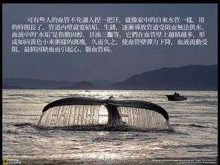 可有些人的血管不免讓人捏一把汗，就像家中的自來水管一樣，用
的時間長了，管道內壁就要結垢、生銹，逐漸導致管道受阻而無法供水。
血液中的“水垢”是指膽固醇、甘油三酯等，它們在血管壁上越積越多，形
成如同黃色小米粥樣的斑塊，久而久之，使血管壁彈力下降，血液流動受
阻，最終因缺血而引起心、腦血管病。

阿拉斯加

 