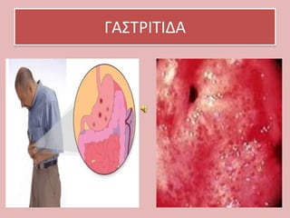 ΓΑ΢ΣΡΙΣΙΔΑ

 