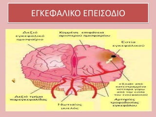 ΕΓΚΕΦΑΛΙΚΟ ΕΠΕΙ΢ΟΔΙΟ

 