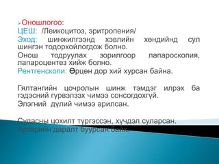 Хэвлийн битүү гэмтэл | PPT