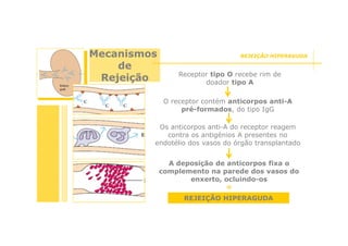 Mecanismos
de
Rejeição

REJEIÇÃO HIPERAGUDA

Receptor tipo O recebe rim de
doador tipo A
O receptor contém anticorpos anti-A
pré-formados, do tipo IgG

Os anticorpos anti-A do receptor reagem
contra os antigénios A presentes no
endotélio dos vasos do órgão transplantado
A deposição de anticorpos fixa o
complemento na parede dos vasos do
enxerto, ocluindo-os
=
REJEIÇÃO HIPERAGUDA

 