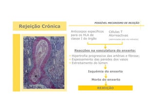 POSSÍVEL MECANISMO DE REJIÇÃO

Rejeição Crónica
Anticorpos específicos
para os HLA de
classe I do órgão

Células T
Alorreactivas
(estimuladas pela via indirecta)

Reacções na vasculatura do enxerto:
Hipertrofia progressiva das artérias e fibrose;
Espessamento das paredes dos vasos
Estreitamento do lúmen
Isquémia do enxerto
Morte do enxerto
REJEIÇÃO

 