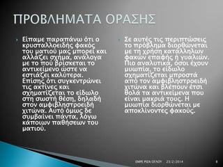 

Είπαμε παπαπάνψ όσι ο
κπτςσαλλοειδήρ υακόρ
σοτ μασιού μαρ μποπεί και
αλλάζει ςφήμα, ανάλογα
με σο πού βπίςκεσαι σο
ανσικείμενο ώςσε να
εςσιάζει καλύσεπα.
Επίςηρ όσι ςτγκενσπώνει
σιρ ακσίνερ και
ςφημασίζεσαι σο είδψλο
ςση ςψςσή θέςη, δηλαδή
ςσον αμυιβληςσποειδή
φισώνα. Ατσό όμψρ δε
ςτμβαίνει πάνσα, λόγψ
κάποιψν παθήςεψν σοτ
μασιού.



΢ε ατσέρ σιρ πεπιπσώςειρ
σο ππόβλημα διοπθώνεσαι
με ση φπήςη κασάλληλψν
υακών επαυήρ ή γταλιών.
Πιο αναλτσικά, όςοι έφοτν
μτψπία, σο είδψλο
ςφημασίζεσαι μπποςσά
από σον αμυιβληςσποειδή
φισώνα και βλέποτν έσςι
θολά σα ανσικείμενα ποτ
είναι μακπιά σοτρ. Η
μτψπία διοπθώνεσαι με
αποκλίνονσερ υακούρ.

ΕΜΡΕ ΡΙΖΑ ΟΓΛΟΤ

23/2/2014

8

 