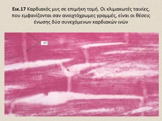 Εικ.17 Καρδιακός μυς σε επιμήκη τομή. Οι κλιμακωτές ταινίες,
που εμφανίζονται σαν ανοιχτόχρωμες γραμμές, είναι οι θέσεις
ένωσης δύο συνεχόμενων καρδιακών ινών

 