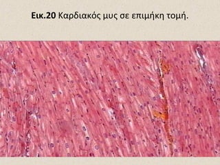 Εικ.20 Καρδιακός μυς σε επιμήκη τομή.

 