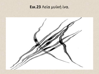 Εικ.23 Λεία μυϊκή ίνα.

 