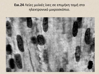 Εικ.24 Λείες μυϊκές ίνες σε επιμήκη τομή στο
ηλεκτρονικό μικροσκόπιο.

 