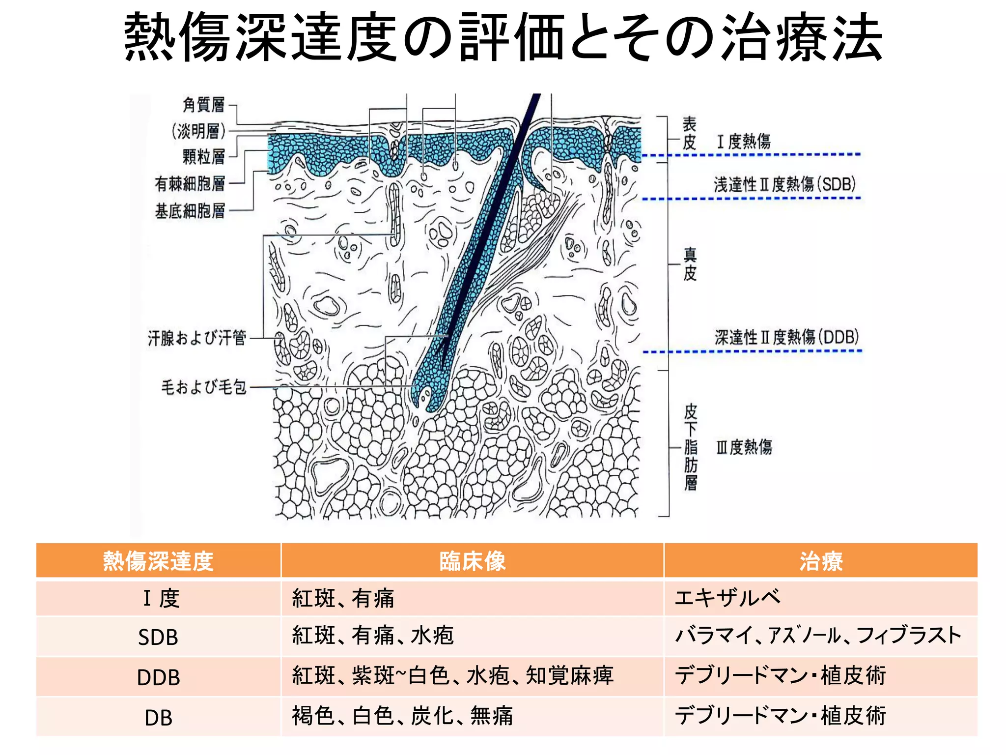 熱傷治療マニュアル 改訂2版 m3電子書籍 | 熱傷治療マニュアル 改訂2版