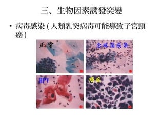 三、生物因素誘發突變
• 病毒感染 ( 人類乳突病毒可能導致子宮頸
癌 )
 