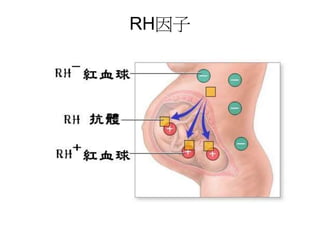 RH因子
 