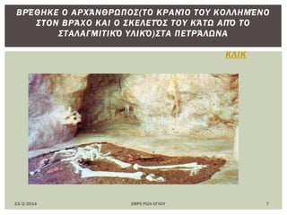 23/2/2014 ΕΜΡΕ ΡΙΖΑ ΟΓΛΟΤ 7
ΠΙ΢ΣΉ ΑΝΑΠΑΡΆ΢ΣΑ΢Η ΣΟΤ ΜΑΤ΢ΩΛΕΊΟΤ ΣΟΤ ΧΏΡΟΤ ΠΟΤ
ΒΡΈΘΗΚΕ Ο ΑΡΧΆΝΘΡΩΠΟ΢(ΣΟ ΚΡΑΝΊΟ ΣΟΤ ΚΟΛΛΗΜΈΝΟ
΢ΣΟΝ ΒΡΆΧΟ ΚΑΙ Ο ΢ΚΕΛΕΣ΋΢ ΣΟΤ ΚΆΣΩ ΑΠ΋ ΣΟ
΢ΣΑΛΑΓΜΙΣΙΚ΋ ΤΛΙΚ΋)΢ΣΑ ΠΕΣΡΆΛΩΝΑ
ΚΛΙΚ
 