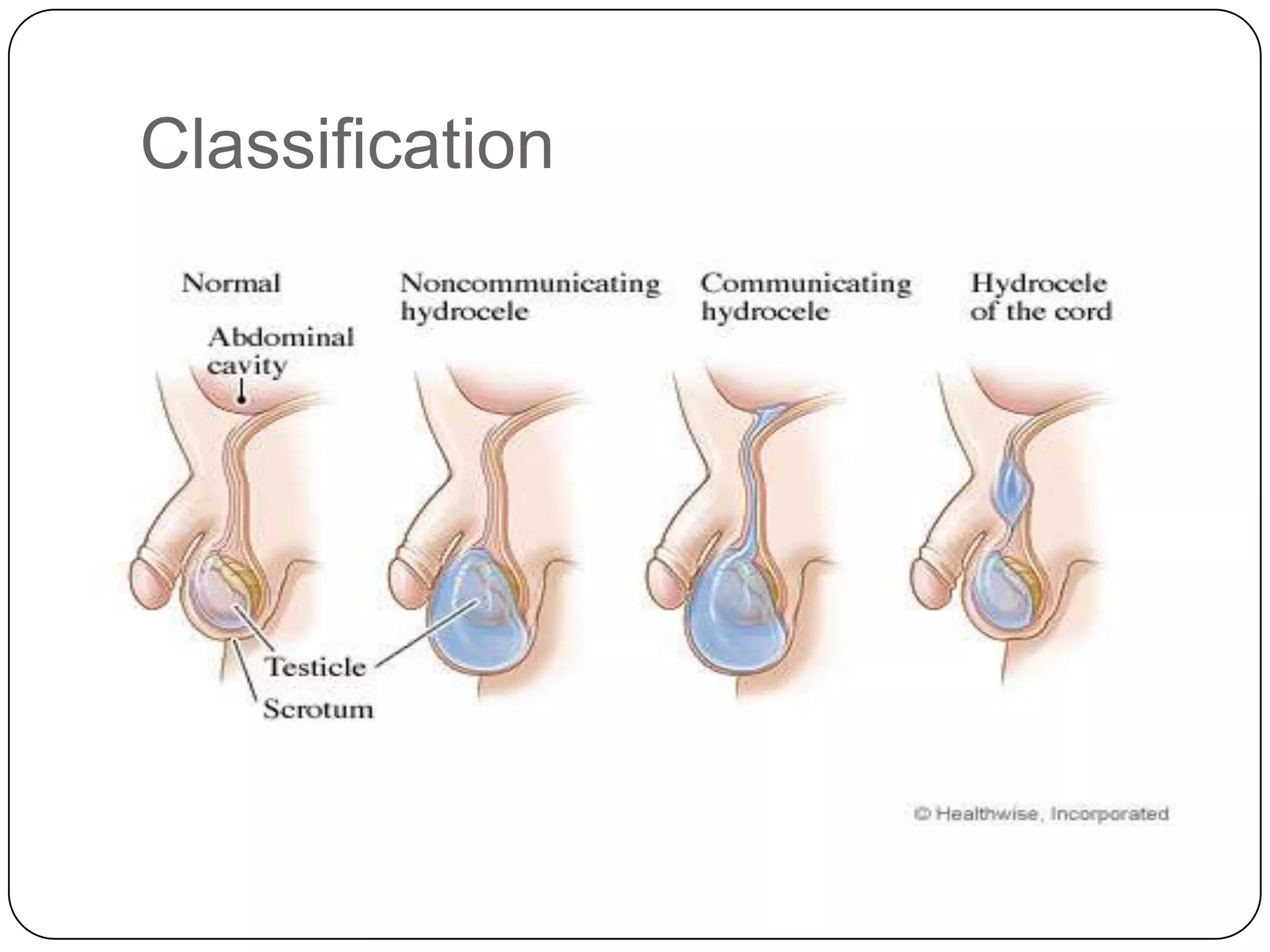 Classification
 