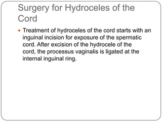 Surgery for Hydroceles of the
Cord
 Treatment of hydroceles of the cord starts with an
inguinal incision for exposure of the spermatic
cord. After excision of the hydrocele of the
cord, the processus vaginalis is ligated at the
internal inguinal ring.
 