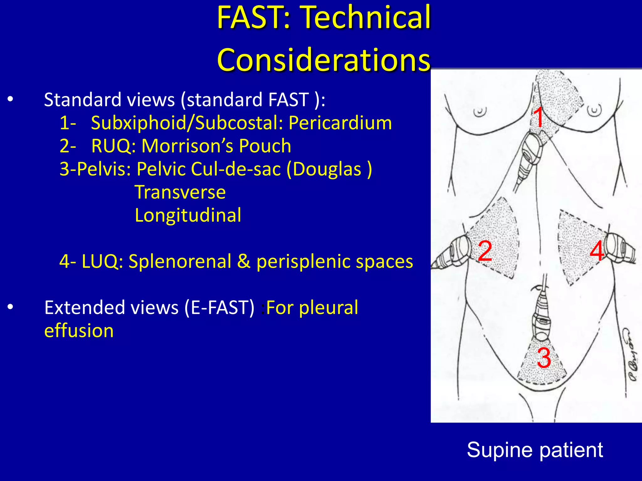 Fast Scan | PPTX