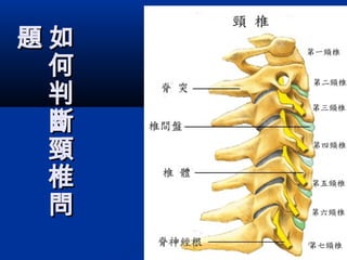 如
何
判
斷
頸
椎
問
如
何
判
斷
頸
椎
問
題題
 