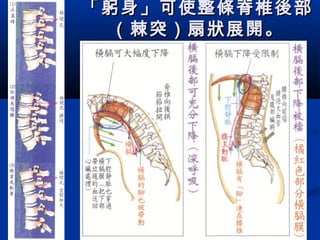 「躬身」可使整條脊椎後部「躬身」可使整條脊椎後部
（棘突）扇狀展開。（棘突）扇狀展開。
  
 