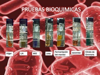 kliger LIA MIO urea
Fermentación
del manitol
sacarosa Citrato de
Simmons
 