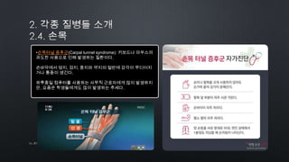 •손목터널 증후군(Carpal tunnel syndrome): 키보드나 마우스의
과도한 사용으로 인해 발생하는 질환이다.
손바닥에서 엄지, 검지, 중지와 약지의 절반에 감각이 무디어지
거나 통증이 생긴다.
하루종일 컴퓨터를 사용하는 사무직 근로자에게 많이 발생하지
만, 요즘은 학생들에게도 많이 발생하는 추세다.
10by 토니토닉
 