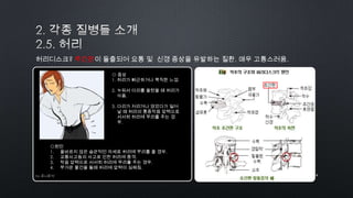14by 토니토닉
허리디스크? 추간판이 돌출되어 요통 및 신경 증상을 유발하는 질환. 매우 고통스러움.
◎원인
1. 올바르지 않은 습관적인 자세로 허리에 무리를 줄 경우.
2. 교통사고등의 사고로 인한 허리에 충격.
3. 작읍 압력으로 서서히 허리에 무리를 주는 경우.
4. 무거운 물건을 들때 허리에 압력이 심해짐.
◎ 증상
1. 허리가 뻐근하거나 묵직한 느낌
2. 누워서 다리를 올렸을 때 허리가
아픔.
3. 다리가 저리거나 앉았다가 일어
날 때 허리의 통증작읍 압력으로
서서히 허리에 무리를 주는 경
우.
 