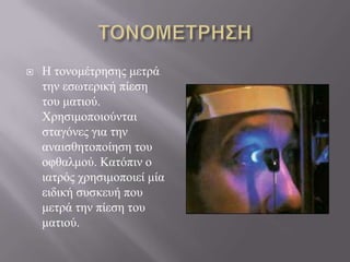 Ζ ηνλνκέηξεζεο κεηξά
ηελ εζσηεξηθή πίεζε
ηνπ καηηνύ.
Φξεζηκνπνηνύληαη
ζηαγόλεο γηα ηελ
αλαηζζεηνπνίεζε ηνπ
νθζαικνύ. Καηόπηλ ν
ηαηξόο ρξεζηκνπνηεί κία
εηδηθή ζπζθεπή πνπ
κεηξά ηελ πίεζε ηνπ
καηηνύ.
 