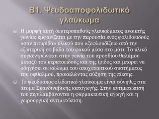  Ζ κνξθή απηή δεπηεξνπαζνύο γιαπθώκαηνο αλνηθηήο
γσλίαο εκθαλίδεηαη κε ηελ παξνπζία ελόο θνιηδνεηδνύο
«ζαλ πηηπξίδα» πιηθνύ πνπ «μεθινπδίδεη» από ηελ
εμσηεξηθή ζηηβάδα ηνπ θαθνύ κέζα ζην κάηη. Τν πιηθό
ζπγθεληξώλεηαη ζηελ γσλία ηνπ πξνζζίνπ ζαιάκνπ
κεηαμύ ηνπ θεξαηνεηδνύο θαη ηεο ίξηδνο θαη κπνξεί λα
νδεγήζεη ζε θώιπκα ηνπ απνρεηεπηηθνύ ζπζηήκαηνο
ηνπ νθζαικνύ, πξνθαιώληαο αύμεζε ηεο πίεζεο.
 Τν ςεπδναπνθνιηδσηηθό γιαύθσκα είλαη ζύλεζεο ζηα
άηνκα Σθαλδηλαβηθήο θαηαγσγήο. Σηελ αληηκεηώπηζή
ηνπ πεξηιακβάλνληαη ε θαξκαθεπηηθή αγσγή θαη ε
ρεηξνπξγηθή αληηκεηώπηζε.
 
