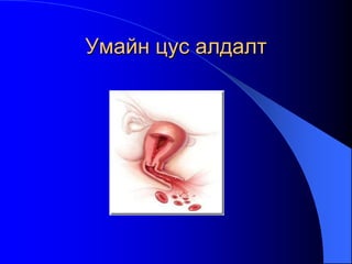 Умайн цус алдалт
 