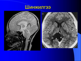 Шинжилгээ
 