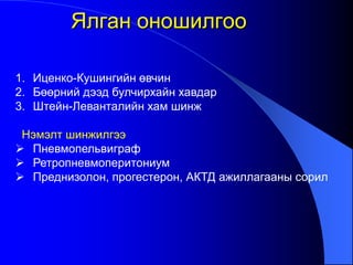 Ялган оношилгоо
1. Иценко-Кушингийн өвчин
2. Бөөрний дээд булчирхайн хавдар
3. Штейн-Леванталийн хам шинж
Нэмэлт шинжилгээ
 Пневмопельвиграф
 Ретропневмоперитониум
 Преднизолон, прогестерон, АКТД ажиллагааны сорил
 