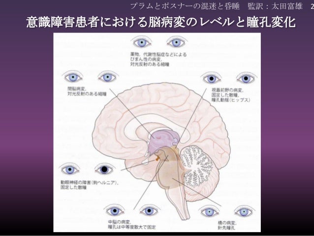 小畑先生発表資料 瞳孔計