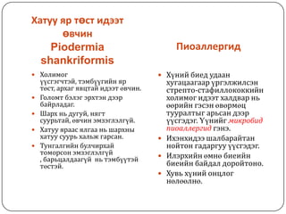 арьсны идээт өвчнүүд | PPT
