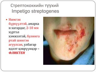арьсны идээт өвчнүүд | PPT