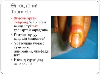арьсны идээт өвчнүүд | PPT