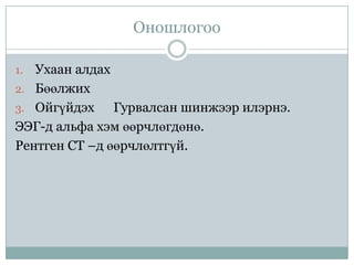 гавал тархины гэмтэл | PPT