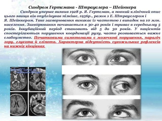 Пріони, їх будова та поширення