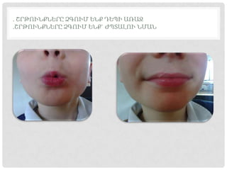 . ՇՐԹՈՒՆՔՆԵՐԸ ՁԳՈՒՄ ԵՆՔ ԴԵՊԻ ԱՌԱՋ
.ՇՐԹՈՒՆՔՆԵՐԸ ՁԳՈՒՄ ԵՆՔ` ԺՊՏԱԼՈՒ ՆՄԱՆ
 