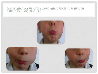 . ՈՒՌԵՑՆՈՒՄ ԵՆՔ ԱՅՏԵՐԸ` ՆԱԽ ԵՐԿՈՒՍԸ ՄԻԱՍԻՆ, ԱՊԱ` ՄԵԿ
ՄԻԱՅՆ ՁԱԽ ԱՅՏԸ, ՄԵԿ` ԱՋԸ:
 