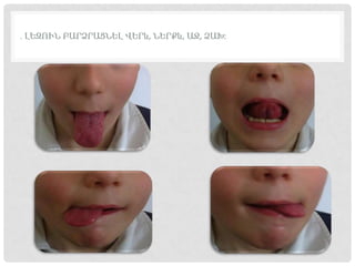 . ԼԵԶՈՒՆ ԲԱՐՁՐԱՑՆԵԼ ՎԵՐև, ՆԵՐՔև, ԱՋ, ՁԱԽ:
 