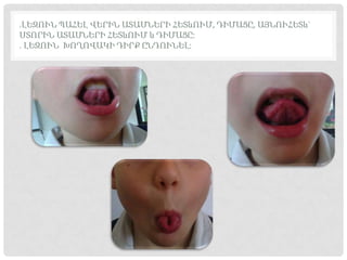 .ԼԵԶՈՒՆ ՊԱՀԵԼ ՎԵՐԻՆ ԱՏԱՄՆԵՐԻ ՀԵՏևՈՒՄ, ԴԻՄԱՑԸ, ԱՅՆՈՒՀԵՏև`
ՍՏՈՐԻՆ ԱՏԱՄՆԵՐԻ ՀԵՏևՈՒՄ և ԴԻՄԱՑԸ:
. ԼԵԶՈՒՆ ԽՈՂՈՎԱԿԻ ԴԻՐՔ ԸՆԴՈՒՆԵԼ:
 