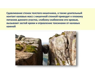 Сдавливание стенок толстого кишечника, а также длительный
контакт каловых масс с кишечной стенкой приводят к плохому
питанию данного участка, слабому снабжению его кровью,
вызывают застой крови и отравление токсинами от каловых
камней
 