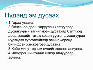 Нүдэнд эм дусаах
 1.Гараа угаана.
2.Өвчтөнөө дээш харуулан хэвтүүлээд
дусаагуурын тагийг нээн дусаахад бэлтгээд
доод зовхийг татаж ховил үүсгэн дусаагуураа
нүдэндээ хүргэлгүйгээр эмийг жоронд
бичигдсэн хэмжээгээр дусаана.
3.Хоёр минут орчим нүдийг зөөлөн аниулна.
4.Илүүдэл шингэнийг цэвэр алчуураар
арчина.
 
