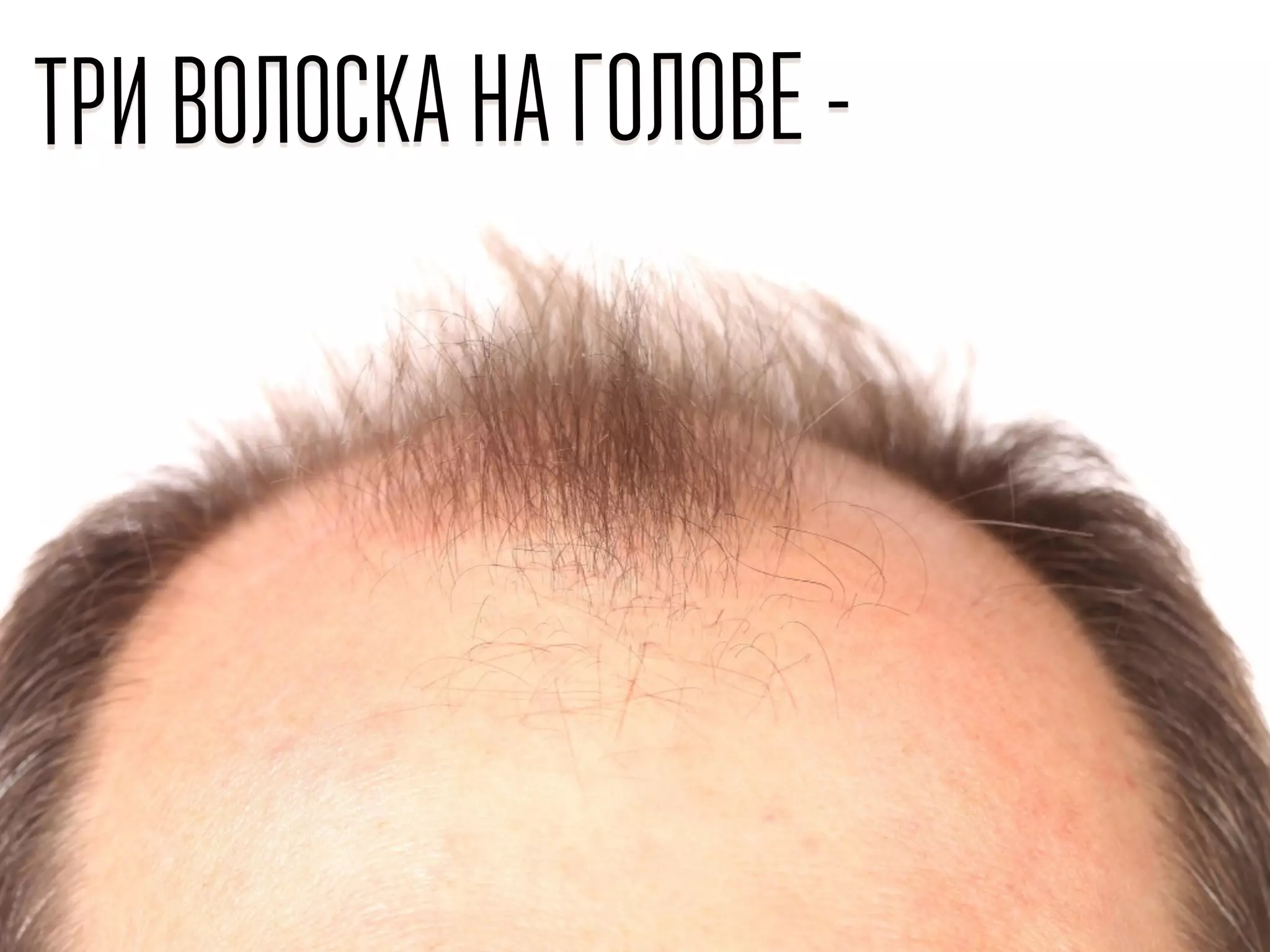 ТРИ ВОЛОСКА НА ГОЛОВЕ -
 
