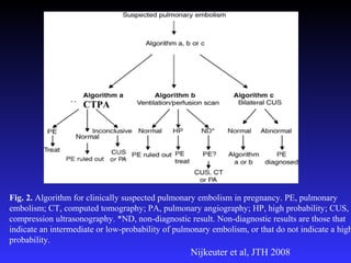 Fig. 2. Algorithm for clinically suspected pulmonary embolism in pregnancy. PE, pulmonary
embolism; CT, computed tomography; PA, pulmonary angiography; HP, high probability; CUS,
compression ultrasonography. *ND, non-diagnostic result. Non-diagnostic results are those that
indicate an intermediate or low-probability of pulmonary embolism, or that do not indicate a high
probability.
CTPA
Nijkeuter et al, JTH 2008
 