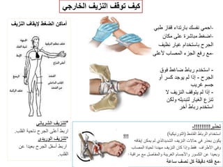 ‫الشمس‬ ‫بضربة‬ ‫المصاب‬ ‫إلسعاؾ‬
1-‫وظلٌل‬ ‫بارد‬ ‫مكان‬ ‫إلى‬ ‫المصاب‬ ‫انقل‬
2-‫مستلقٌا‬ ‫المصاب‬ ‫اجعل‬
3-‫الجسم‬ ‫مستوى‬ ‫أعلى‬ ‫القدمٌن‬ ‫رفع‬
4-‫السوابل‬ ‫من‬ ‫كمٌة‬ ‫المصاب‬ ً‫أعط‬
5-‫باردة‬ ‫كمادات‬ ‫له‬ ‫اعمل‬
6-‫الحالة‬ ‫وتطور‬ ‫والنبض‬ ‫التنفس‬ ‫راقب‬
7-‫المستشفى‬ ‫إلى‬ ‫المصاب‬ ‫انقل‬
‫دكتور‬/‫القوي‬ ‫عبد‬ ‫محمد‬
dr_ markis@yahoo.com
 
