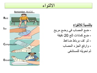 ‫األولى‬ ‫الطرٌقة‬:
‫لألصابع‬ ‫ثمانٌة‬ ‫رقم‬ ‫شكل‬ ‫على‬ ‫رباط‬
‫المعصم‬ ‫و‬
‫الثانٌة‬ ‫الطرٌقة‬:
‫األصابع‬ ‫تضمٌد‬:
 