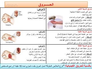 ‫حروق‬‫األولى‬ ‫الدرجة‬
‫السطحٌة‬ ‫الطبقة‬ ‫تصٌب‬ ً‫الت‬ ً‫وه‬
‫الخارجٌة‬‫للجلد‬
‫إلسعافه‬:‫اخلع‬‫والساعات‬ ‫الخواتم‬
‫و‬ ‫بلطف‬ ‫والثٌاب‬‫الثلج‬ ‫تستعمل‬ ‫ال‬
‫بارد‬ ‫ماء‬ ً‫ف‬ ‫أو‬ ‫تحت‬ ‫المصاب‬ ‫الجزء‬ ‫ضع‬
‫من‬10‫إلى‬45‫كمادة‬ ‫استخدم‬ ‫أو‬ ‫دقٌقة‬‫باردة‬
‫استخدم‬‫للحروق‬ ‫مرهم‬
‫األعراض‬:
‫وانتفاخ‬ ‫تورم‬ ‫وربما‬ ‫احمرار‬
‫مع‬‫شدٌد‬ ‫ألم‬
ً‫ف‬‫وحولها‬ ‫المصابة‬ ‫المنطقة‬
‫الثانٌة‬ ‫الدرجة‬ ‫حروق‬
‫الخارجٌة‬ ‫الطبقة‬ ‫عبر‬ ‫تمتد‬‫الداخلٌة‬ ‫الطبقة‬ ‫إلى‬(‫األدمة‬)
‫إلسعافه‬:‫أغمر‬‫باردة‬ ‫كمادة‬ ‫ضع‬ ‫أو‬ ‫البارد‬ ‫بالماء‬ ‫الحرق‬
‫الثٌاب‬ ‫تنزع‬ ‫ال‬‫إذا‬‫كانت‬‫ملتصقة‬‫و‬‫ال‬‫الفقاعات‬ ‫تفتح‬
‫المصاب‬ ‫أعط‬‫سوابل‬‫وراجع‬‫المستشفى‬
‫األعراض‬:
‫سوابل‬ ‫وإفراز‬ ‫وفقاعات‬ ‫تورم‬
‫مع‬‫شدٌد‬ ‫ألم‬
‫حروق‬‫الثالثة‬ ‫الدرجة‬
‫الجلد‬ ‫طبقات‬ ‫كل‬ ‫إلى‬ ‫تمتد‬ ‫عمٌقة‬ ‫حروق‬
‫وقد‬‫والعظام‬ ‫العضالت‬ ‫إلى‬ ‫تصل‬
‫إلسعافه‬:‫أبعد‬‫مكان‬ ‫عن‬ ‫المصاب‬‫الخطر‬
‫والحظ‬‫بالصدمة‬ ‫اإلصابة‬ ‫أو‬ ‫التنفس‬
‫الجرح‬ ‫على‬ ‫شٌبا‬ ‫تضع‬ ‫وال‬ ‫جافة‬ ‫بضمادة‬ ‫الحرق‬ ‫غط‬
‫اتصل‬‫إلى‬ ‫المصاب‬ ‫أنقل‬ ‫أو‬ ‫باإلسعاف‬‫المستشفى‬
‫األعراض‬:
‫متفحم‬ ‫أو‬ ‫اسود‬ ‫أو‬ ‫ابٌض‬ ‫الحرق‬ ‫ٌبدو‬
‫قد‬‫بحروق‬ ‫مصحوبا‬ ‫ٌكون‬
‫من‬‫والثانٌة‬ ‫األولى‬ ‫الدرجة‬
‫وقد‬‫باأللم‬ ‫ٌشعر‬ ‫ال‬
‫نتٌجة‬‫الطرفٌة‬ ‫األعصاب‬ ‫تلف‬
‫الحــــــروق‬
‫الكٌمٌائٌة‬ ‫للحروق‬ ‫بالنسبة‬:*‫الملوثة‬ ‫المالبس‬ ‫انزع‬*‫لمدة‬ ‫الجاري‬ ‫بالماء‬ ‫الحرق‬ ‫اغسل‬15‫دقٌقة‬*‫المستشفى‬ ‫وراجع‬
‫دكتور‬/‫القوي‬ ‫عبد‬ ‫محمد‬
dr_ markis@yahoo.com
 