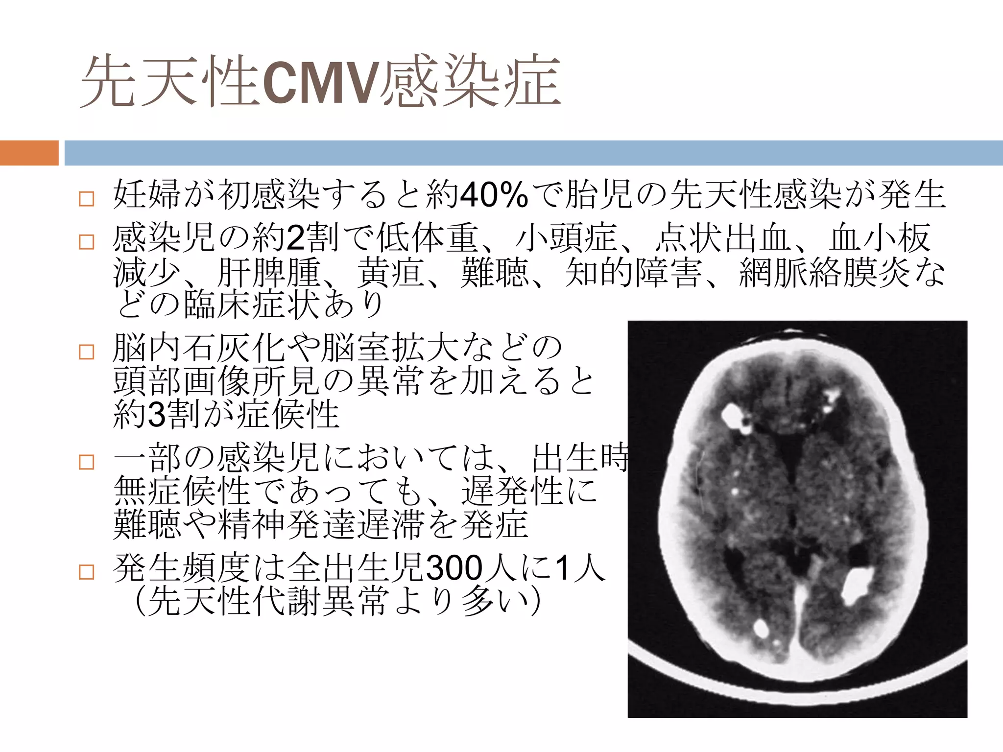 先天性CMV感染症
 妊婦が初感染すると約40%で胎児の先天性感染が発生
 感染児の約2割で低体重、小頭症、点状出血、血小板
減尐、肝脾腫、黄疸、難聴、知的障害、網脈絡膜炎な
どの臨床症状あり
 脳内石灰化や脳室拡大などの
頭部画像所見の異常を加えると
約3割が症候性
 一部の感染児においては、出生時
無症候性であっても、遅発性に
難聴や精神発達遅滞を発症
 発生頻度は全出生児300人に1人
（先天性代謝異常より多い）
 
