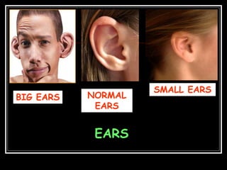 EARS
BIG EARS
SMALL EARS
NORMAL
EARS
 