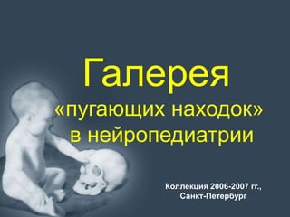 Коллекция 2006-2007 гг.,
Санкт-Петербург
Галерея
«пугающих находок»
в нейропедиатрии
 