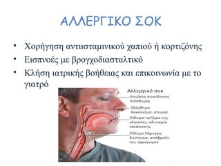 ΑΛΛΕΡΓΙΚΟ ΣΟΚ
• Χορήγηση αντιισταμινικού χαπιού ή κορτιζόνης
• Εισπνοές με βρογχοδιασταλτικό
• Κλήση ιατρικής βοήθειας και επικοινωνία με το
γιατρό
 
